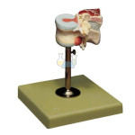 First Lumbar Vertebra with Intervertebral Discs & Back Muscles Model